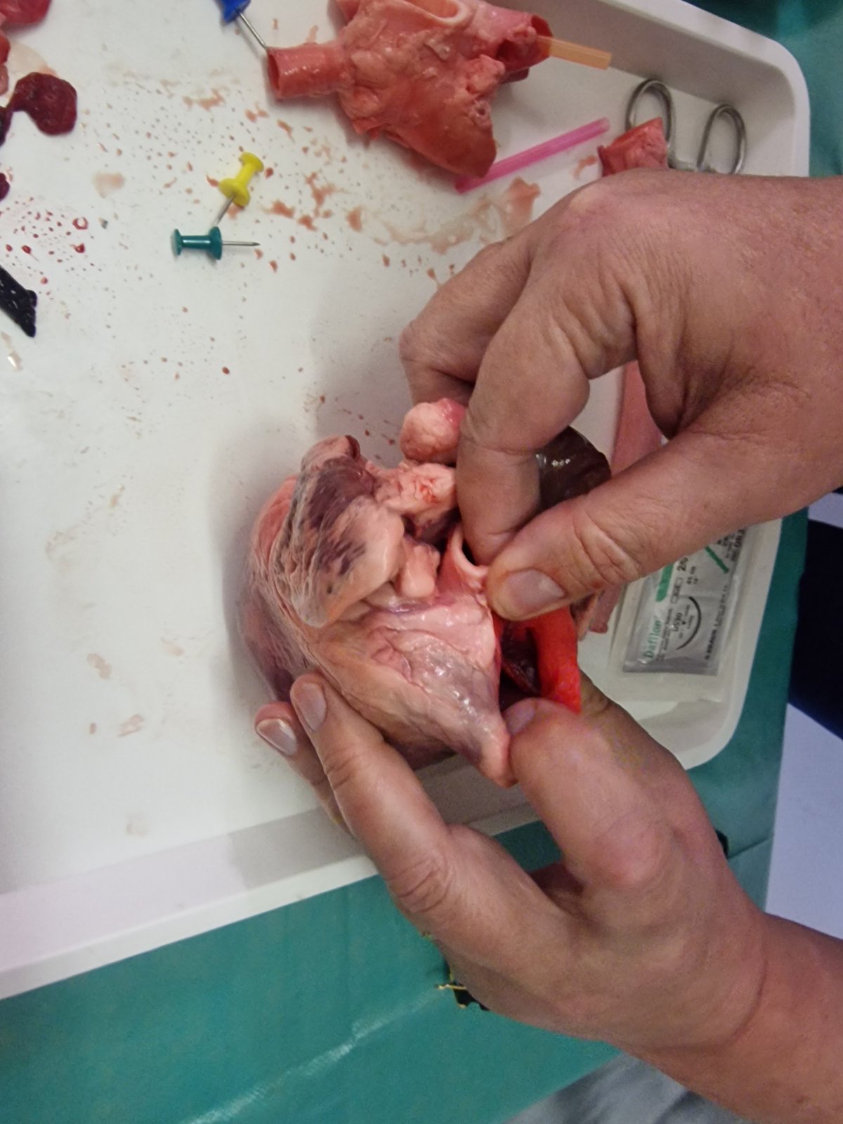 Munkahelyi egészségfejlesztés 31